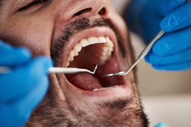 Best Emergency Dental Care for Broken or Chipped Teeth in Baxter Village, SC