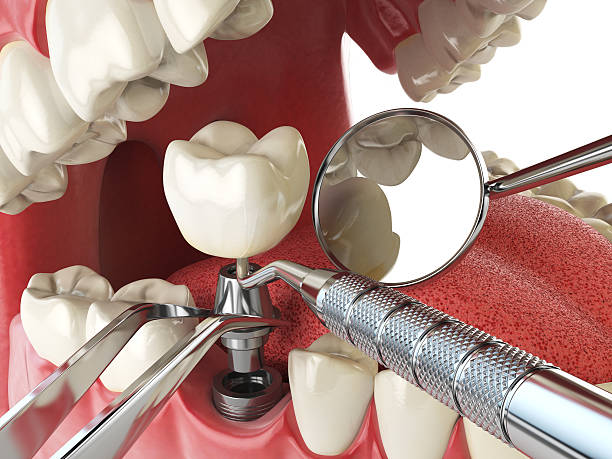 Best Emergency Gum Treatment in Baxter Village, SC